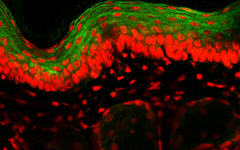Cross-section of the skin