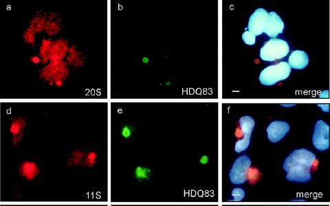 Colocalization of huntingtin protein aggregates with components of the ubiquitin proteasome system