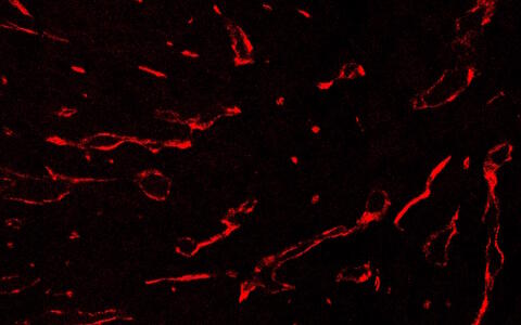 Blood vessels, IFN-gamma untreated