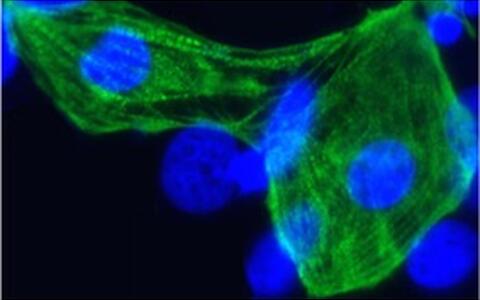 The researchers have differentiated the stem cells into cardiac cells.