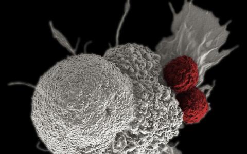 T-Zellen (rot gefärbt) beim Angriff auf eine Krebszelle