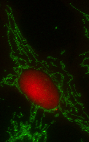 HeLa cell