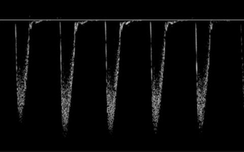 Descending_Aorta_crop_resize