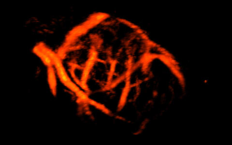 power-doppler_3d_testicle