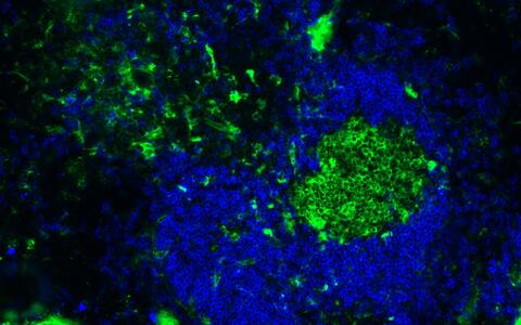 B2 cells in the spleen