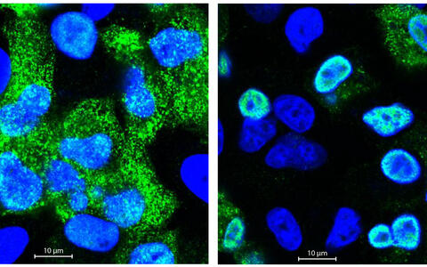 Influenza Selbach Lab