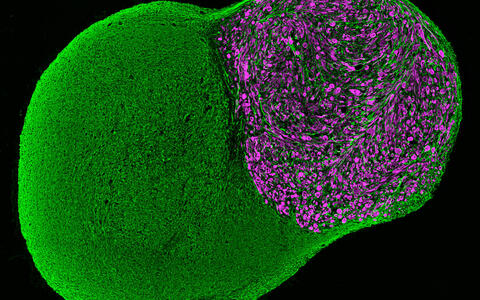 Neuromuscular_Organoid