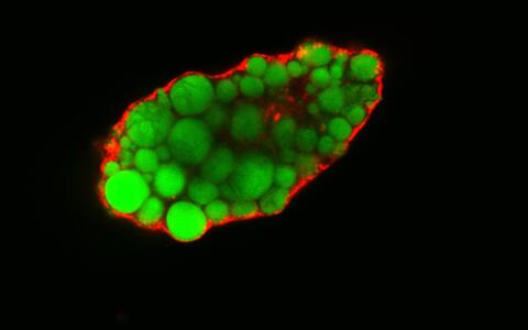 Lipidtropfen Fettzelle Adipocyte