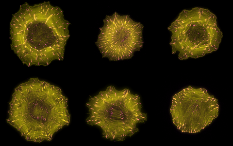 Aktinfasern und fokale Adh&auml;sionen