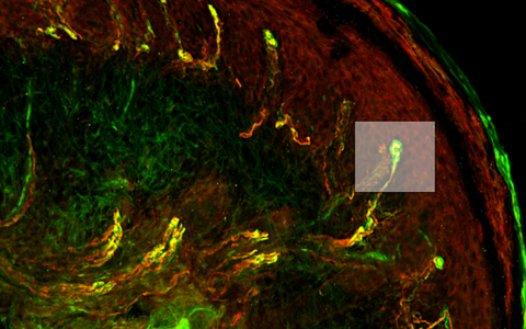 Cross section through skin