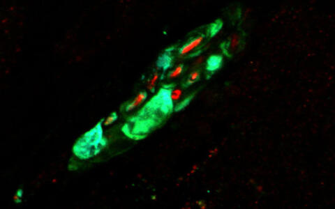 Highlighted receptor in high resolution