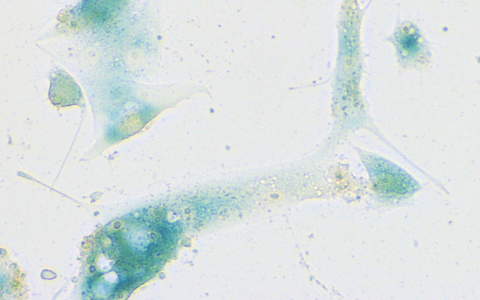 Seneszente humane ACE2-exprimierende Nasenepithelzellen nach SARS-CoV-2-Infektion