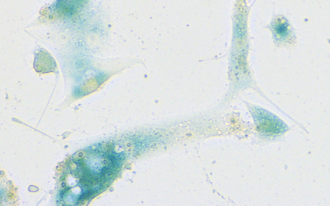 Human nasal mucosa cells