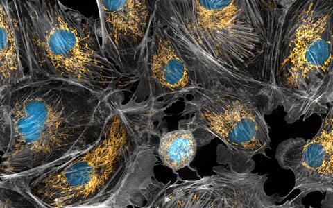 cow cells taken with a microscope. the mitochondria were stained in bright yellow to visualize them in the cell. The large blue dots are the cell nuclei and the gray web is the cytoskeleton of the cells.