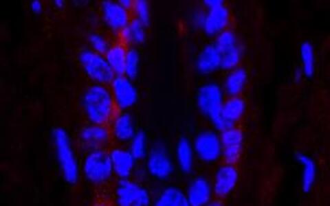 NF-κB activity in the secondary hair germ (SGH) in a telogen hair follicle (in red).