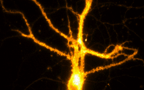 TIRF-Fluoreszenzmikroskopie zeigt die Aktivität primärer Neuronen des Hippocampus. Die Daten wurden von Dr. Zohreh Farsi aufgenommen.