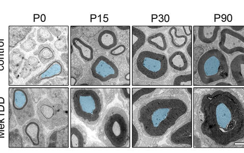 Expression of Mek1DD in Schwann cells compensates for the loss of Shp2 or ErbB3.