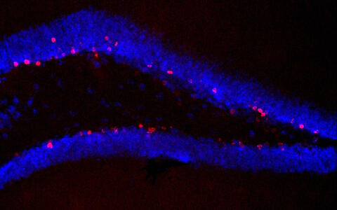 Hippocampus_neue-Zellen_unbehandelte_Tiere_k&ouml;rperl_Training-300x188