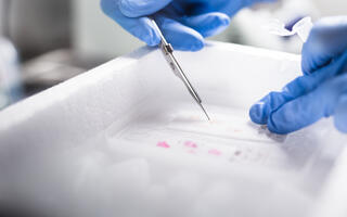 Preparation of the tumor tissue for sequencing