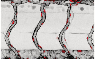 Blood Vessel