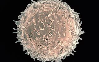 Colorized scanning electron micrograph