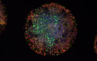 A day-old micropatterned organoid generated from induced pluripotent stem cells (iPSCs) derived from a patient with a mutation in the IRF2BPL gene. The different colors mark distinct cell populations, which reveal how the organoid is organizing into layers of developing neural tissue. It provides a snapshot of early human brain-like development in this patient-derived model.