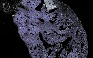 Zebrafish heart after cryoinjury