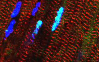RBM20 protein in heart muscle cells shown in light blue.