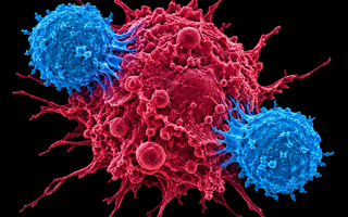 CAR T cells attacking a cancer cell
