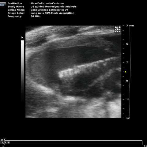 sonographic-view-of-a-conductance-catheter