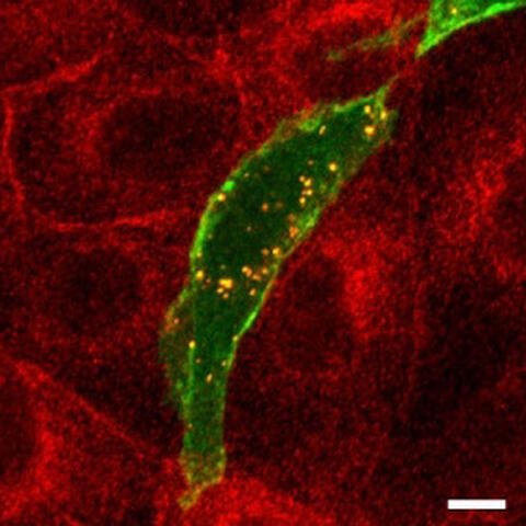 pka_in_cells_oben