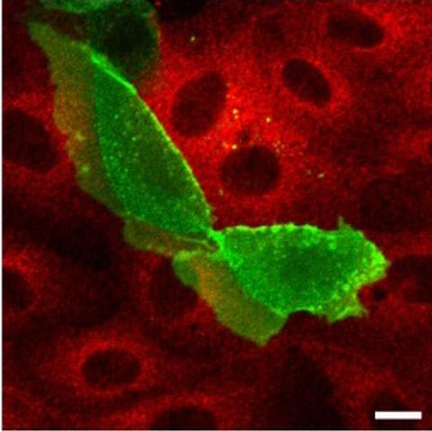 pka_in_cells_unten