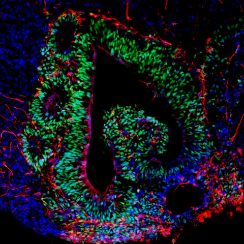 Brain organoids