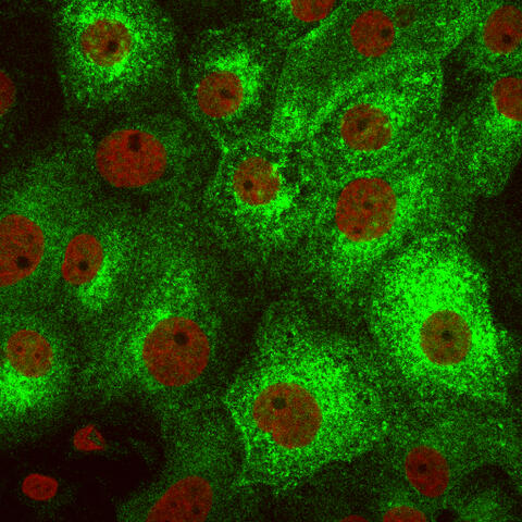 Rat kidney cells, AQP2 marked green