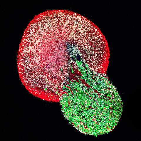 Organoids