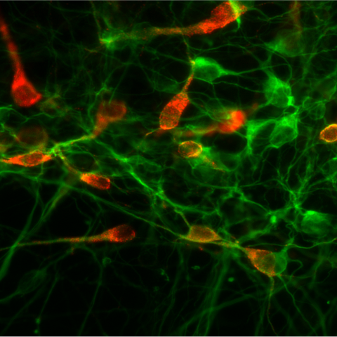 Serotonerge Neuronen im Gehirn