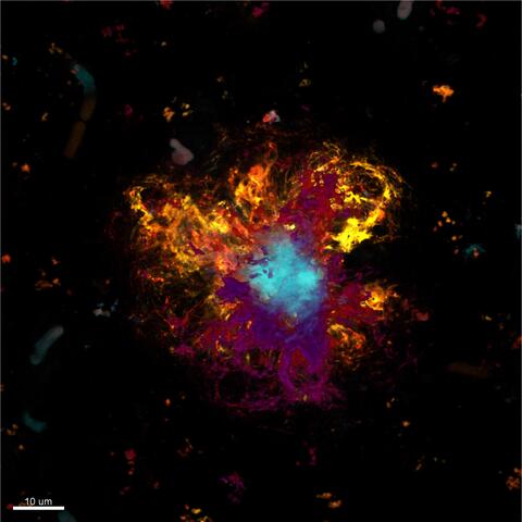 Abbildung von Beta-Amyloid-Plaques