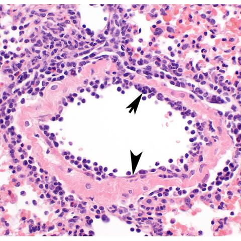 Endothel