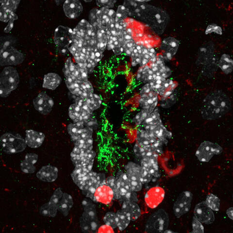 Microscopic image of cilia and neurons