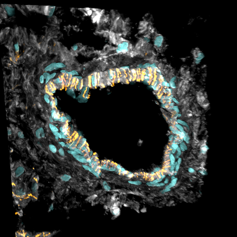 Cross section of an artery of the heart