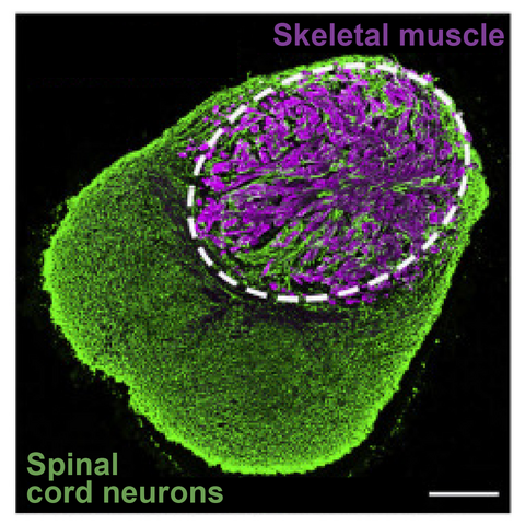 Human neuromuscular organoid