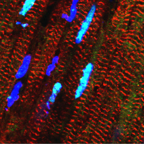 RBM20 protein in heart muscle cells shown in light blue.