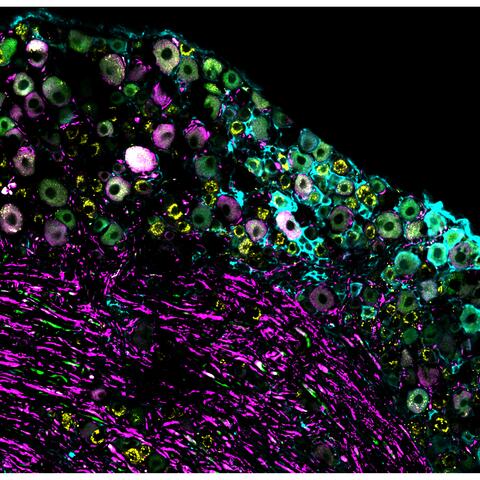 Cluster of mouse nerve cells