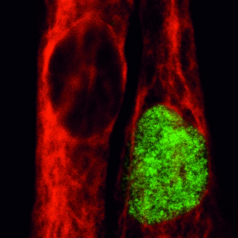 muscle stem cell 1