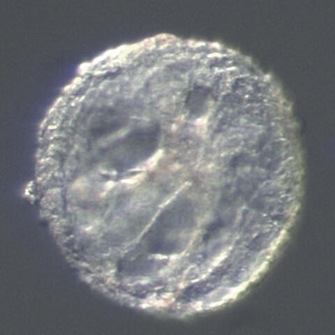 organoid