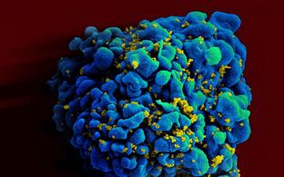 HIV-infected H9 T cell