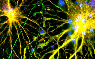 Glia cells (Patient with leigh syndrom)