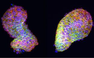 Zebrafish Heart Looping