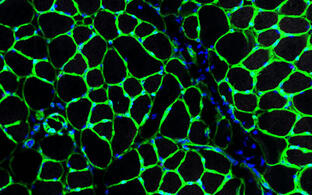 Green sponge-like network of mouse skeletal muscle