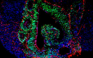 Brain organoids